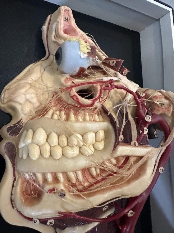 Image 1 of Antique display cabinet - wax model head (facies externa)