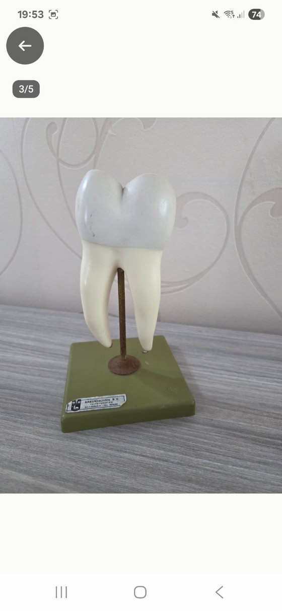 Educational Model Molar with Cavity, Vintage – Breukhoven B.V., Decorative Objects, Metal, Plastic (photo 3 of 5)