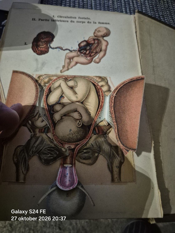 Antico libro medico di riferimento, Libri d'arte, Carta, Tessile, Beige (foto 15 di 15)