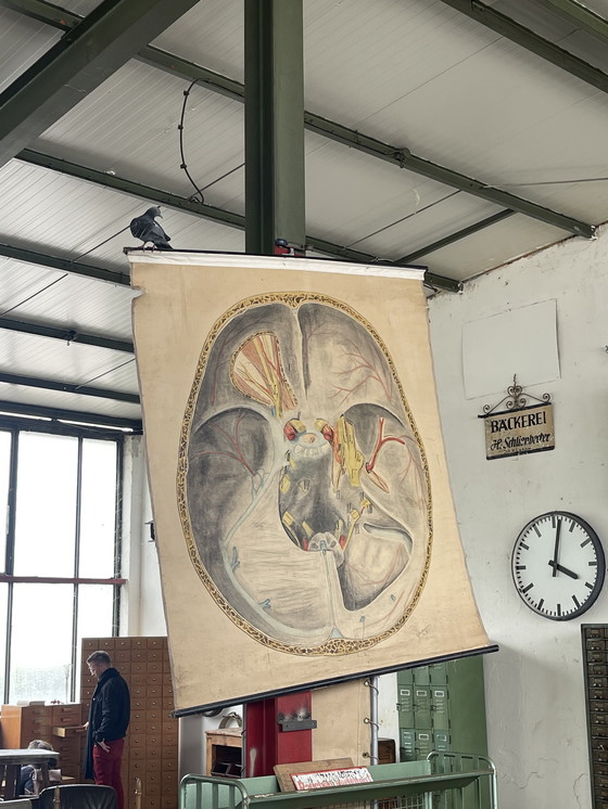 Image 1 of 1911 Cartel anatómico de época de un corte transversal del cerebro humano,