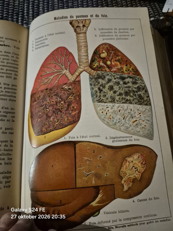 Antico libro medico di riferimento, Libri d'arte, Carta, Tessile, Beige (foto 8 di 15)