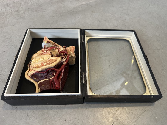 Image 1 of Antique display cabinet - wax model head (facies externa)