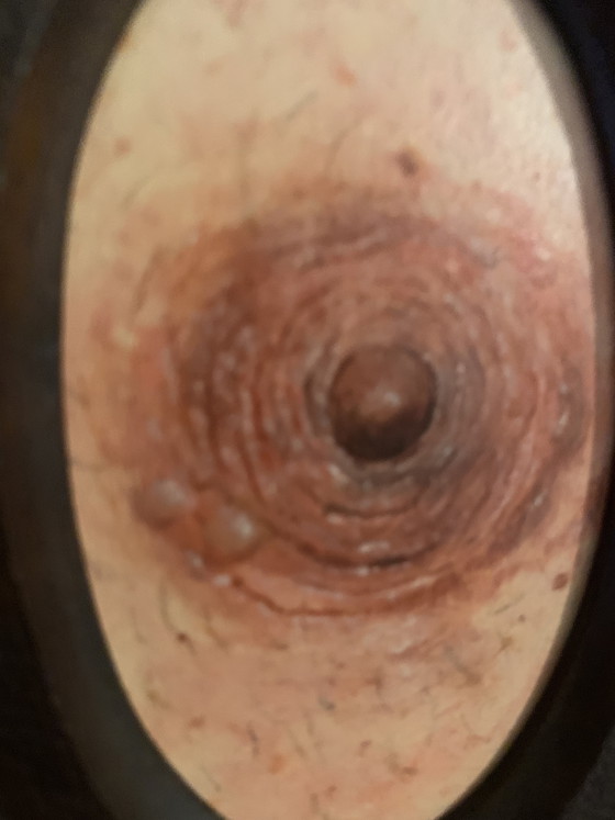 Image 1 of Opera unica di Azenor (AZ) – cornice barocca, illusione di rilievo