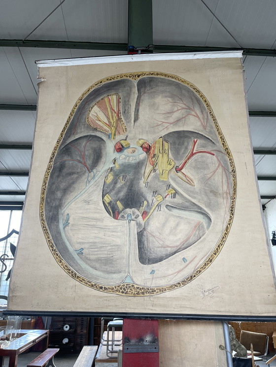 Image 1 of 1911 Cartel anatómico de época de un corte transversal del cerebro humano,