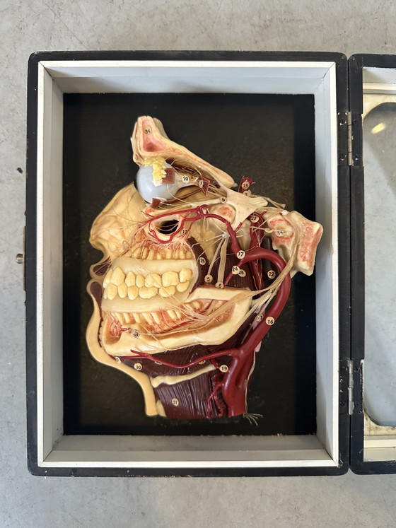 Image 1 of Antique display cabinet - wax model head (facies externa)