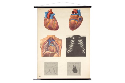 Original Vintage Schulwandkarte Das Herz I Mensch Brustkorb Anatomie Plakat Lehrtafel Rollkarte Biologie DHM Dresden DDR