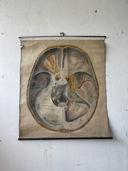 1911 Poster Vintage anatomische Karte eines Querschnitts durch das menschliche Gehirn,