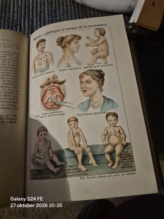Antico libro medico di riferimento, Libri d'arte, Carta, Tessile, Beige (foto 10 di 15)