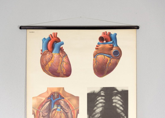 Image 1 of Original Vintage Schulwandkarte Das Herz I Mensch Brustkorb Anatomie Plakat Lehrtafel Rollkarte Biologie DHM Dresden DDR