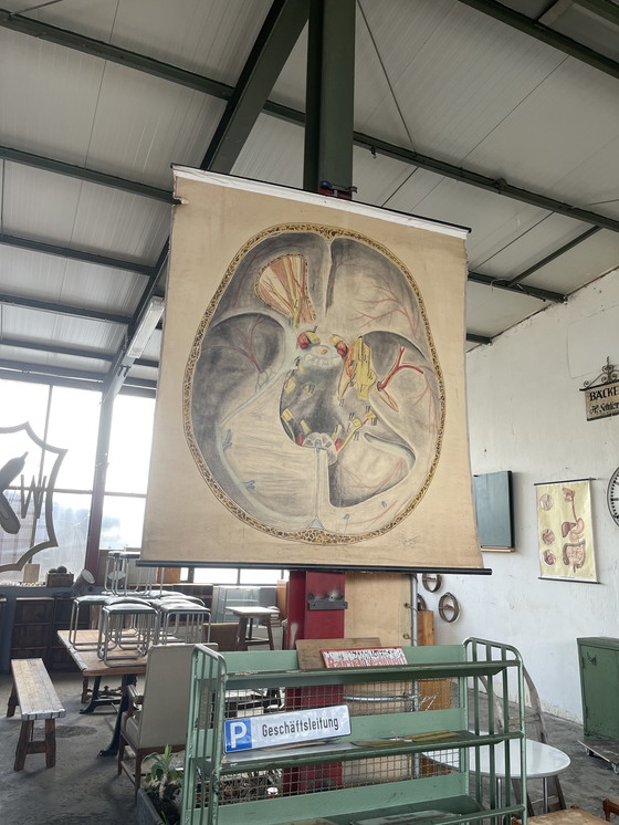 Image 1 of 1911 Cartel anatómico de época de un corte transversal del cerebro humano,