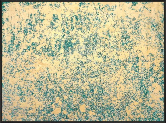 Image 1 of Jürgen Angeler - Golden Snowfall