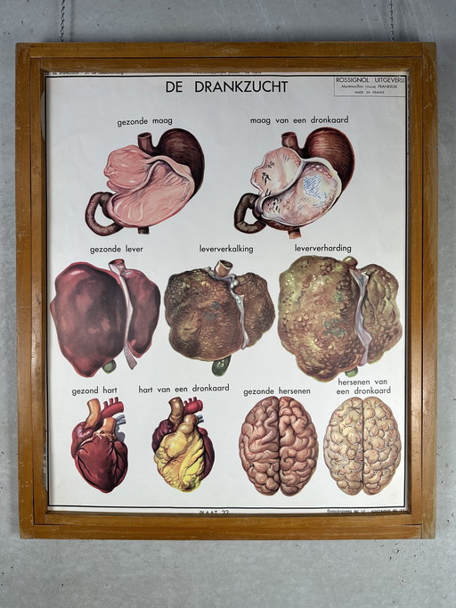 22x vintage schoolplaten ‘anatomie’ in wisselkader