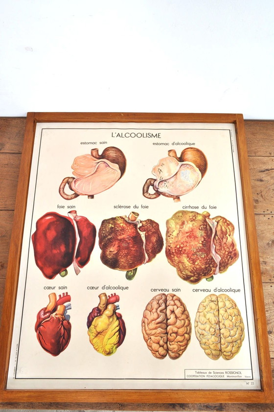 Image 1 of Vintage Wissellijst Anatomie Met 11 Dubbelzijdige Platen 