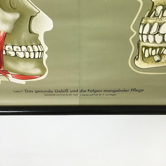 Image 1 of Vintage educational poster on teeth by Jung-Koch Quentell, 1960