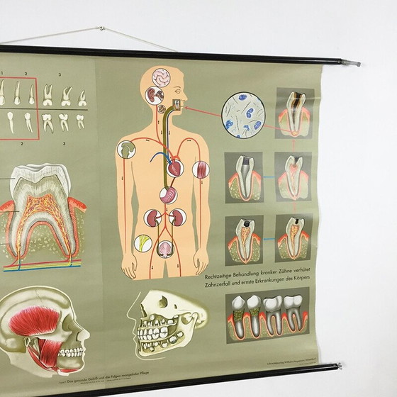 Image 1 of Vintage educational poster on teeth by Jung-Koch Quentell, 1960