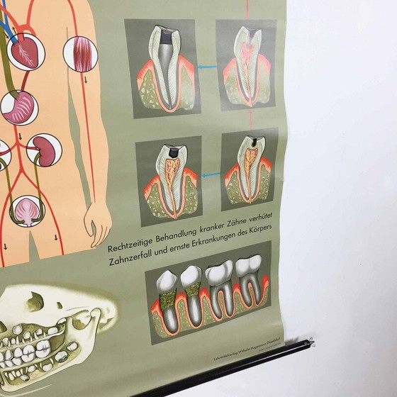 Image 1 of Vintage educational poster on teeth by Jung-Koch Quentell, 1960