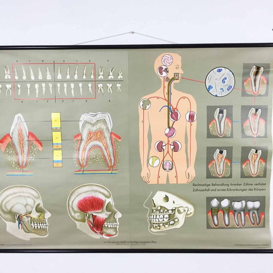 Image 1 of Vintage educational poster on teeth by Jung-Koch Quentell, 1960