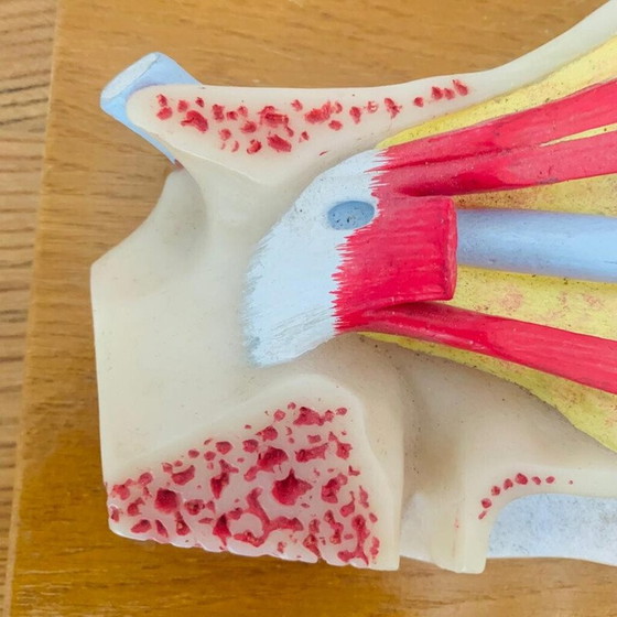 Image 1 of Vintage skinned représentant une coupure de l'œil