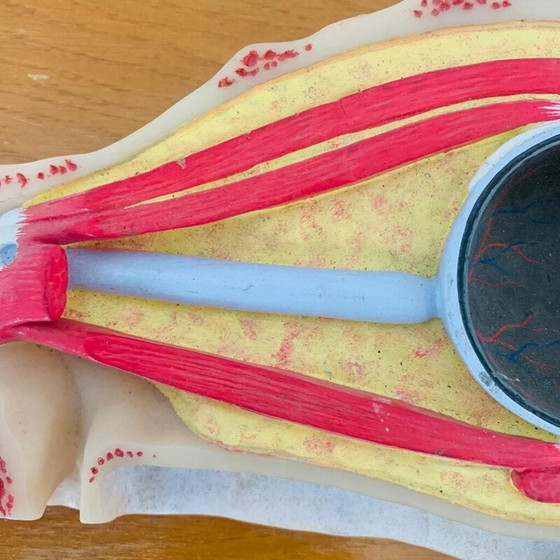 Image 1 of Weinlese gehäutet, die einen Schnitt am Auge darstellt