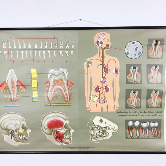 Image 1 of Aufklärungsplakat über Zähne von Jung-Koch Quentell, 1960